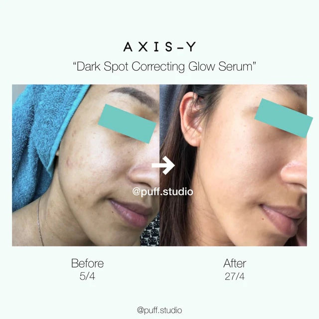 Axis-Y Glowing Skin Serum